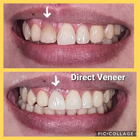 leon's pride dental clinic|Leon's Pride Dental Clinic .